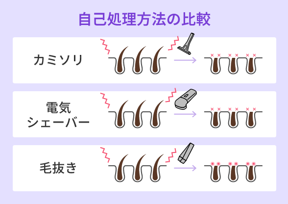 自己処理方法の比較