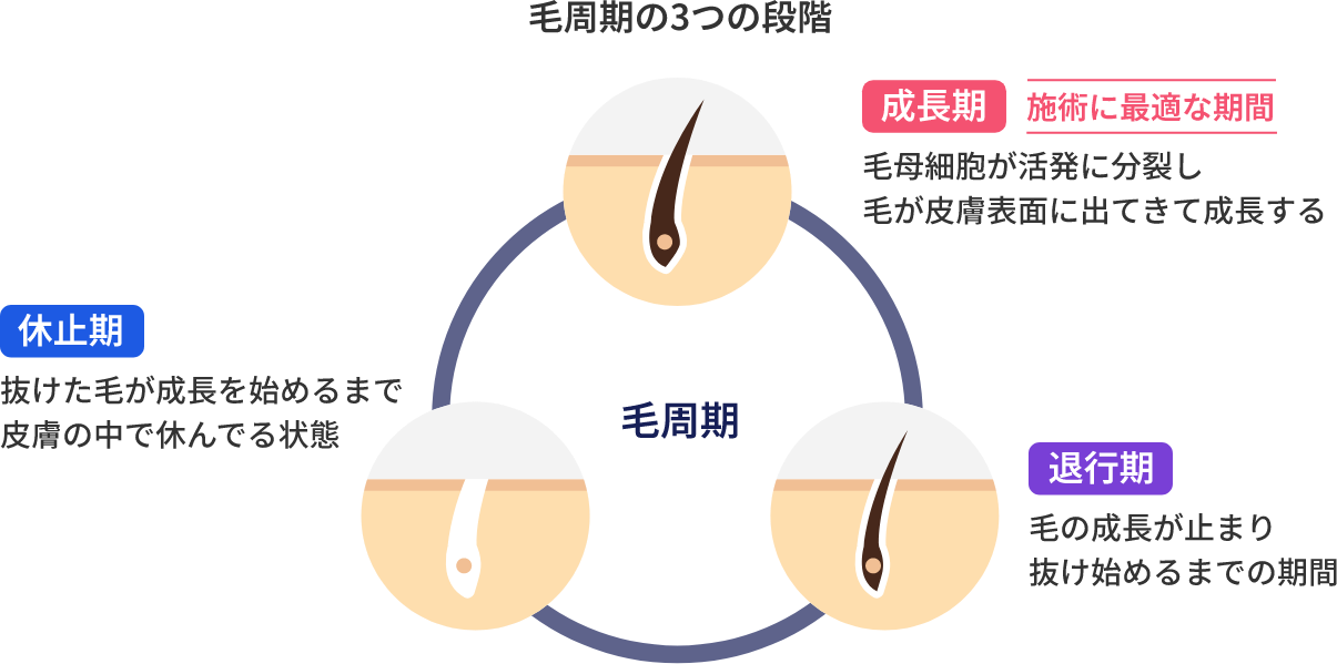 毛周期の3つの段階